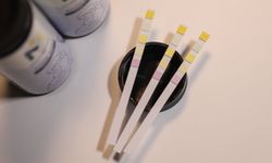 Dünyada 5 parametre bakılabilen tek testle anne sütünün değerleri ölçülüyor