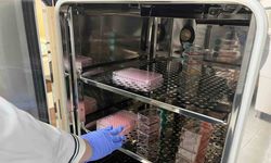 Parkinson’da bağırsak- beyin iletişimi çip üstü organ teknolojisiyle araştırılıyor