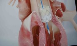 Prof. Dr. Pekdemir: 'Gençlerde ani ölümlerin yüzde 90'ı genetik nedenlerden kaynaklanıyor'