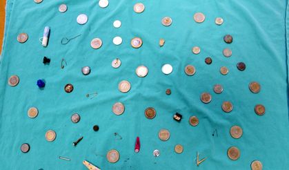 Profesörün, 'yanlışlıkla yutulanlar' koleksiyonu