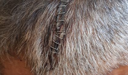 Eğlence mekanında darbedildiği iddiasıyla şikayetçi oldu