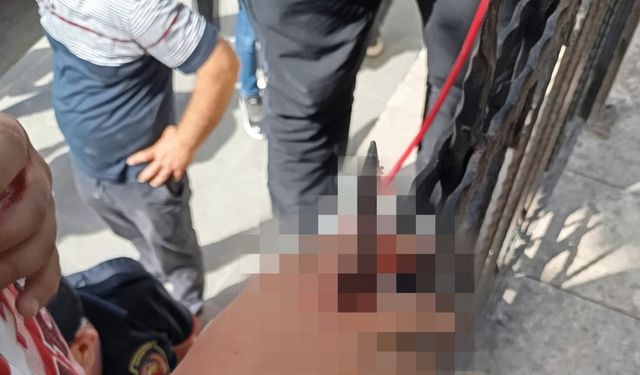 Dut yemek isterken eli korkuluk demirine saplandı