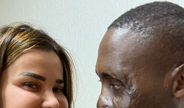 Ankara- Yüzü yanan Ugandalı çoban Ankara'da tedavi edildi /Video eklendi
