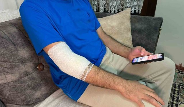 Başakşehir’de sitenin güvenlik görevlisine sahipli köpek saldırdı