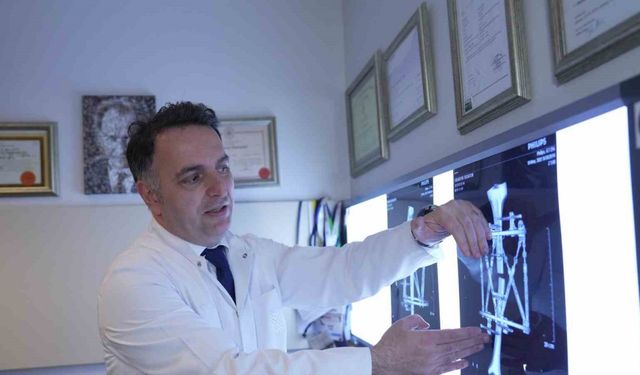 Boy kısalığına karşı modern çözüm: kemik uzatma yöntemleri