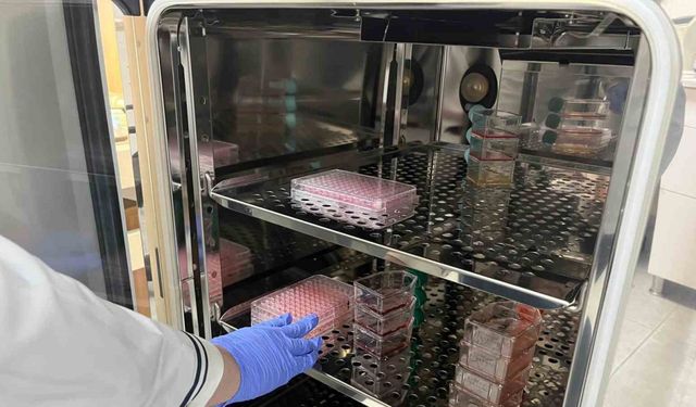 Parkinson’da bağırsak- beyin iletişimi çip üstü organ teknolojisiyle araştırılıyor