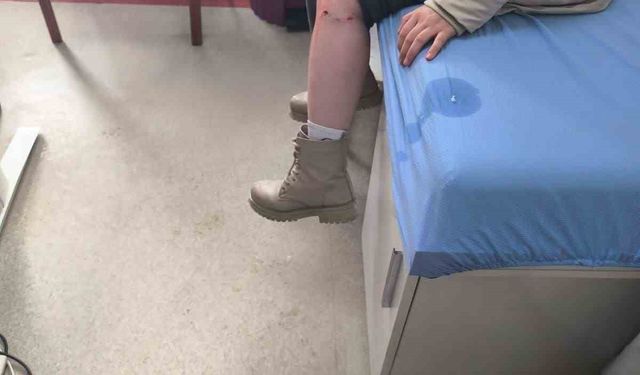 Kayseri'de sokak köpeğinin saldırısına uğrayan çocuk yaralandı