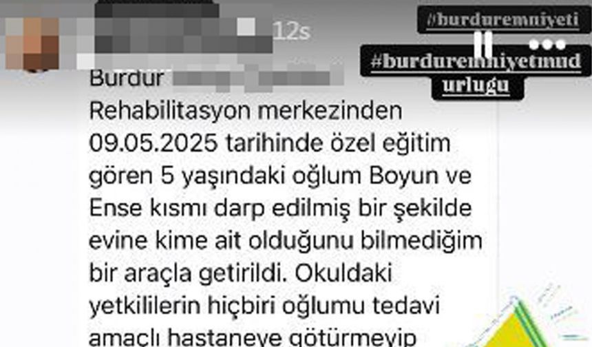 Rehabilitasyon merkezinde 5 yaşında çocuğa darp iddiasına soruşturma