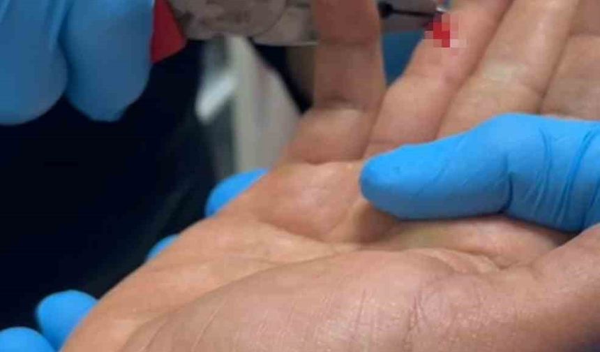 Balık macerası hastanede bitti: Parmağına saplanan olta iğnesini itfaiye çıkarttı